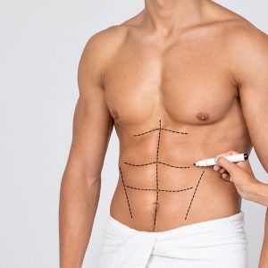 Six Pack Surgery Male, Doctor Drawing