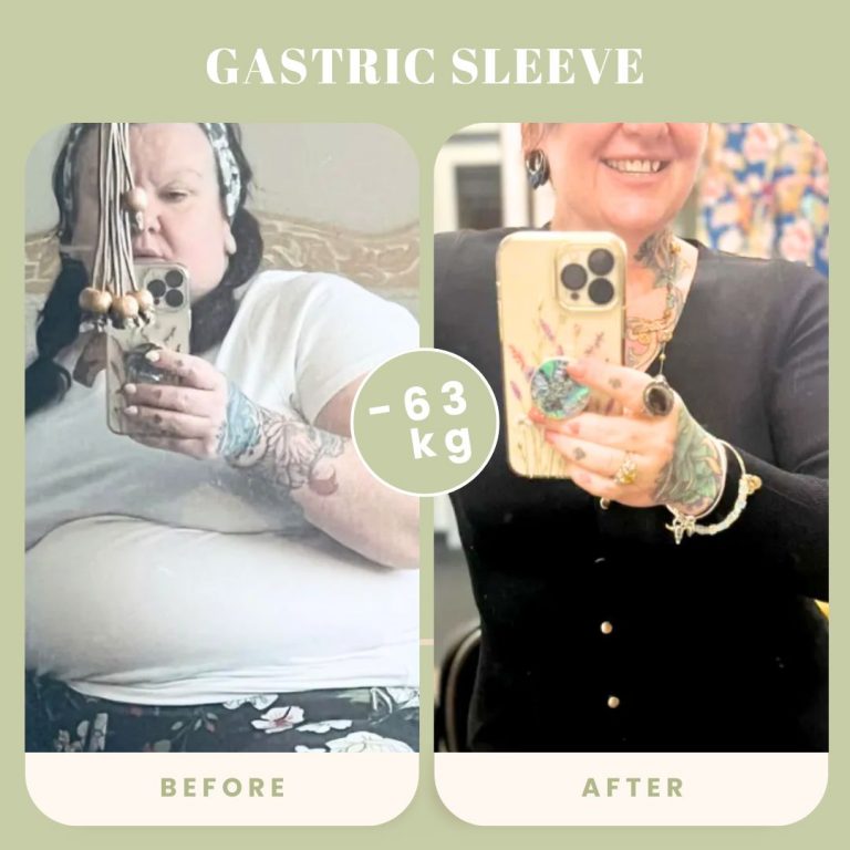 obesity-before-after-17