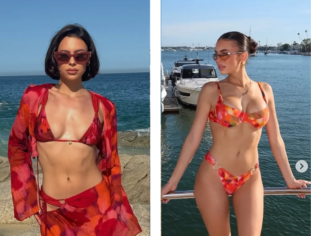 Breast lift before and after result at Estexper Clinic